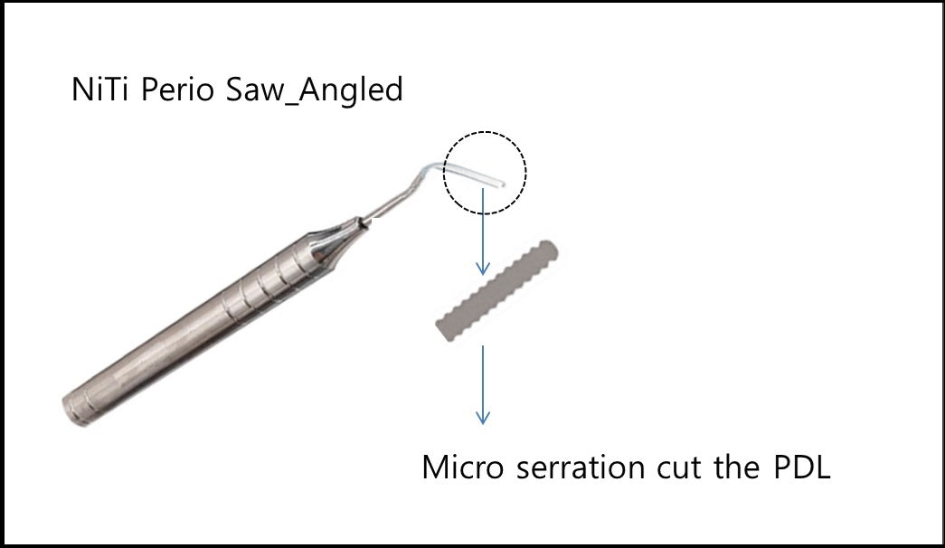 NiTi Perio Saw Angled tip, product photo